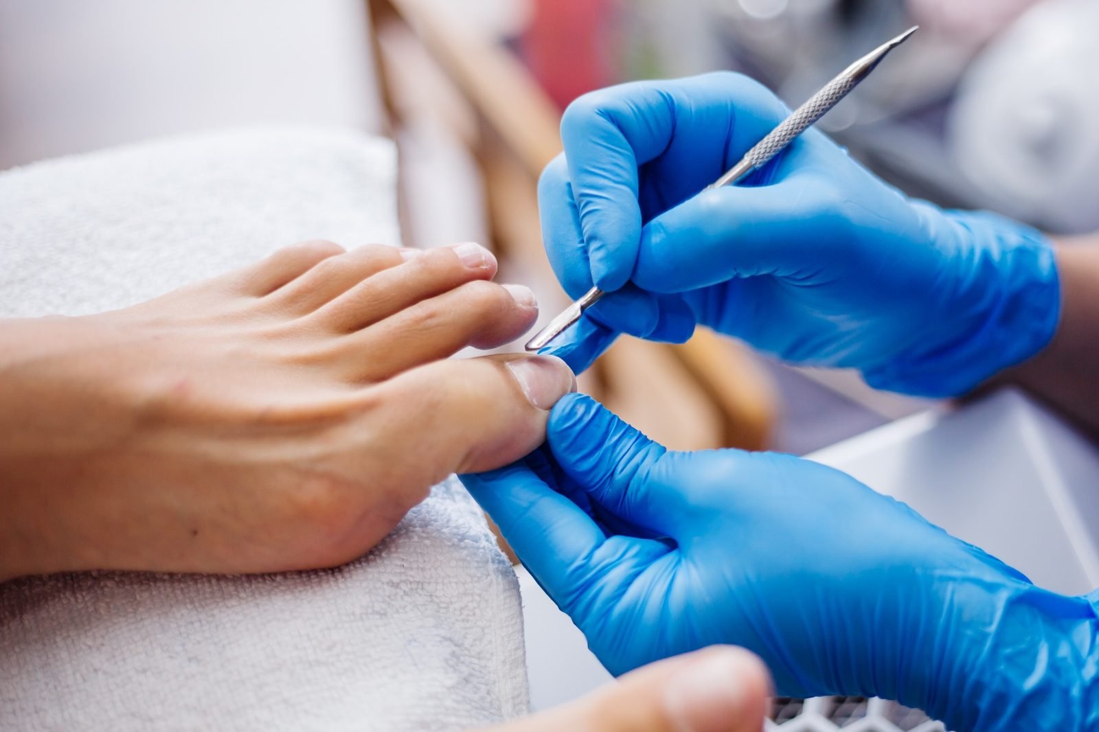 Cuidado Unhas Encravadas Queluz